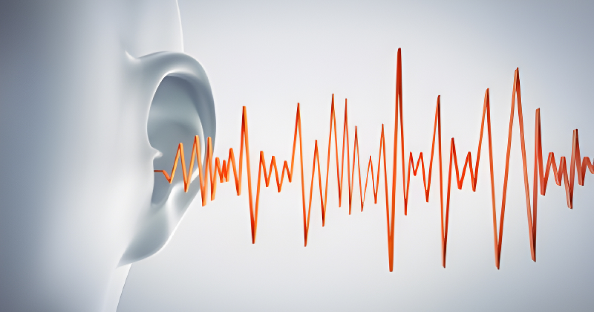 Traitement acoustique dans l’industrie agroalimentaire